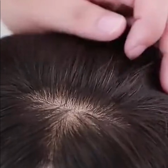 Crown Hair Toppers for Thinning Hair- Natural Black - Length: 10” Size: 3x5 in. - Picture 6 of 6